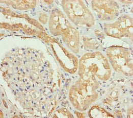 Immunohistochemistry of paraffin-embedded human kidney tissue using SLC34A1 Antibody at dilution of 1:100Rabbit anti-Human SLC34A1 Polyclonal Antibody