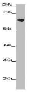 Western blotAll lanes: SLC34A1 antibody at 1:150+ Mouse brain tissueSecondaryGoat polyclonal to rabbit IgG at 1/10000 dilutionPredicted band size: 69, 37 kDaObserved band size: 69 kDaRabbit anti-Human SLC34A1 Polyclonal Antibody