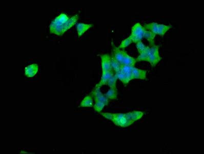 Immunofluorescence staining of 293 cells with SPTBN1 Antibody at 1:66, counter-stained with DAPI. The cells were fixed in 4% formaldehyde, permeabilized using 0.2% Triton X-100 and blocked in 10% normal Goat Serum. The cells were then incubated with the antibody overnight at 4°C. The secondary antibody was Alexa Fluor 488-congugated AffiniPure Goat Anti-Rabbit IgG(H+L).Rabbit anti-Human SPTBN1 Polyclonal Antibody