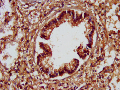 IHC image of the antibody diluted at 1:200 and staining in paraffin-embedded human lung tissue performed on a Leica BondTM system. After dewaxing and hydration, antigen retrieval was mediated by high pressure in a citrate buffer (pH 6.0). Section was blocked with 10% normal goat serum 30min at RT. Then primary antibody (1% BSA) was incubated at 4°C overnight. The primary is detected by a biotinylated secondary antibody and visualized using an HRP conjugated SP system.Rabbit anti-Human SPTBN1 Polyclonal Antibody