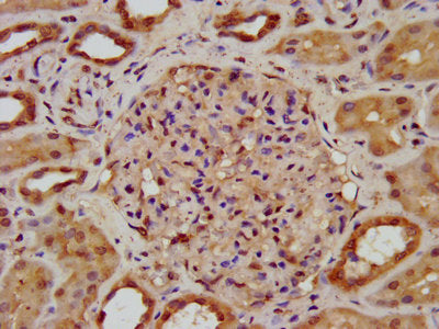 IHC image of SPTBN1 Antibody diluted at 1:200 and staining in paraffin-embedded human kidney tissue performed on a Leica BondTM system. After dewaxing and hydration, antigen retrieval was mediated by high pressure in a citrate buffer (pH 6.0). Section was blocked with 10% normal goat serum 30min at RT. Then primary antibody (1% BSA) was incubated at 4°C overnight. The primary is detected by a biotinylated secondary antibody and visualized using an HRP conjugated SP system.Rabbit anti-Human SPTBN1 Polyclonal Antibody