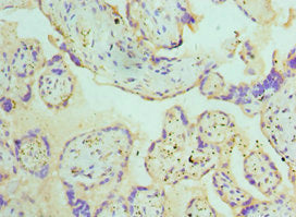Immunohistochemistry of paraffin-embedded human placenta tissue using ATG16L1 Antibody at dilution of 1:100Rabbit anti-Human ATG16L1 Polyclonal Antibody