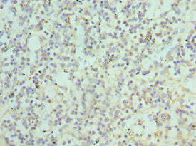 Immunohistochemistry of paraffin-embedded human spleen tissue using ATG16L1 Antibody at dilution of 1:100Rabbit anti-Human ATG16L1 Polyclonal Antibody