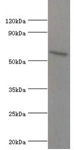 Western blot  | All lanes: ATG16L1 antibody at 2µg/ml + MCF-7 whole cell lysate  | Secondary  | Goat polyclonal to rabbit IgG at 1/10000 dilution  | Predicted band size: 69, 67, 54, 48, 50 kDa  | Observed band size: 69 kDa