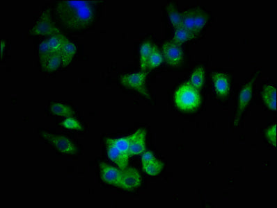 Immunofluorescence staining of HepG2 cells with the antibody at 1:333, counter-stained with DAPI. The cells were fixed in 4% formaldehyde, permeabilized using 0.2% Triton X-100 and blocked in 10% normal Goat Serum. The cells were then incubated with the antibody overnight at 4°C. The secondary antibody was Alexa Fluor 488-congugated AffiniPure Goat Anti-Rabbit IgG(H+L).
