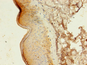 Immunohistochemistry of paraffin-embedded human skin tissue using ATG16L1 Antibody at dilution of 1:100Rabbit anti-Human ATG16L1 Polyclonal Antibody