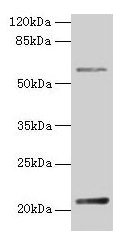 Western blot  | All lanes: DUSP13 antibody at 4µg/ml + Hela whole cell lysate  | Secondary  | Goat polyclonal to rabbit IgG at 1/10000 dilution  | Predicted band size: 21, 23, 7, 28, 8, 10, 18 kDa  | Observed band size: 21 kDaRabbit anti-Human DUSP13 Polyclonal Antibody