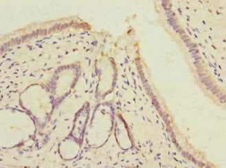 Immunohistochemistry of paraffin-embedded human pancreatic tissue using VARS Antibody at dilution of 1:100Rabbit anti-Human VARS Polyclonal Antibody
