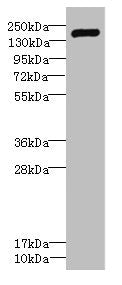 Western blot | All lanes: VARS antibody IgG at 2.29μg/ml + Hela whole cell lysate | Secondary | Goat polyclonal to rabbit IgG at 1/10000 dilution | Predicted band size: 141, 34 kDa | Observed band size: 141 kDaRabbit anti-Human VARS Polyclonal Antibody