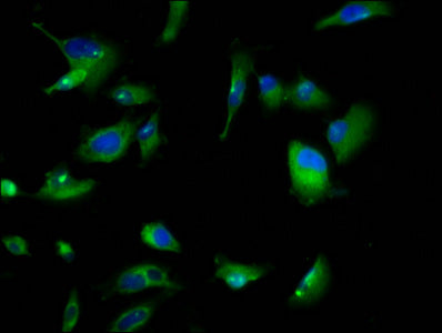 Immunofluorescence staining of U251 cells with GPR158 Antibody at 1:166, counter-stained with DAPI. The cells were fixed in 4% formaldehyde, permeabilized using 0.2% Triton X-100 and blocked in 10% normal Goat Serum. The cells were then incubated with the antibody overnight at 4°C. The secondary antibody was Alexa Fluor 488-congugated AffiniPure Goat Anti-Rabbit IgG(H+L).Rabbit anti-Human GPR158 Polyclonal Antibody