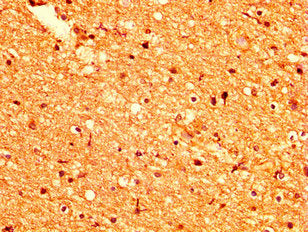 IHC image of the antibody diluted at 1:500 and staining in paraffin-embedded human brain tissue performed on a Leica BondTM system. After dewaxing and hydration, antigen retrieval was mediated by high pressure in a citrate buffer (pH 6.0). Section was blocked with 10% normal goat serum 30min at RT. Then primary antibody (1% BSA) was incubated at 4°C overnight. The primary is detected by a biotinylated secondary antibody and visualized using an HRP conjugated SP system.Rabbit anti-Human GPR158 Polyclonal Antibody