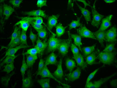 Immunofluorescence staining of NIH/3T3 cells with THEMIS2 Antibody at 1:133, counter-stained with DAPI. The cells were fixed in 4% formaldehyde, permeabilized using 0.2% Triton X-100 and blocked in 10% normal Goat Serum. The cells were then incubated with the antibody overnight at 4°C. The secondary antibody was Alexa Fluor 488-congugated AffiniPure Goat Anti-Rabbit IgG(H+L).Rabbit anti-Human THEMIS2 Polyclonal Antibody