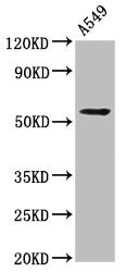 Western Blot  | Positive WB detected in: A549 whole cell lysate  | All lanes: THEMIS2 antibody at 4.2µg/ml  | Secondary  | Goat polyclonal to rabbit IgG at 1/50000 dilution  | Predicted band size: 73, 30, 57, 14, 58, 51 kDa  | Observed band size: 57 kDaRabbit anti-Human THEMIS2 Polyclonal Antibody