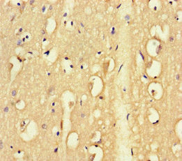 Immunohistochemistry of paraffin-embedded human brain tissue using TENT5C Antibody at dilution of 1:100Rabbit anti-Human TENT5C Polyclonal Antibody