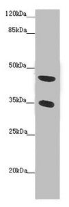 Western blot  | All lanes: TENT5C antibody at 2 μg/ml + Mouse heart tissue  | Secondary  | Goat polyclonal to rabbit IgG at 1/10000 dilution  | Predicted band size: 45 kDa  | Observed band size: 45, 35 kDaRabbit anti-Human TENT5C Polyclonal Antibody