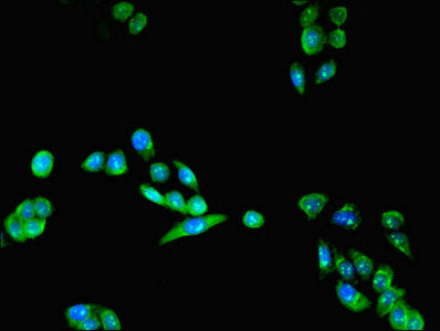 Immunofluorescent analysis of PC-3 cells using LYPLAL1 Antibody at dilution of 1:100 and Alexa Fluor 488-congugated AffiniPure Goat Anti-Rabbit IgG(H+L)
