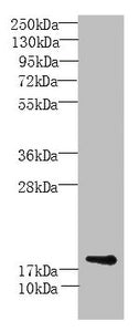 Western Blot  | All lanes: MORN5 antibody at 4µg/ml + Mouse brain tissue  | Secondary  | Goat polyclonal to rabbit IgG at 1/10000 dilution  | Predicted band size: 19, 21 kDa  | Observed band size: 19 kDaRabbit anti-Human MORN5 Polyclonal Antibody
