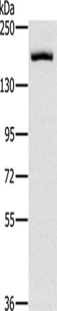 Gel: 6%SDS-PAGE, Lysate: 40 μg, Lane: Hela cells, Primary antibody: ERBB4 Antibody(ERBB4 Antibody) at dilution 1/200, Secondary antibody: Goat anti rabbit IgG at 1/8000 dilution, Exposure time: 5 secondsRabbit anti-Human ERBB4 Polyclonal Antibody