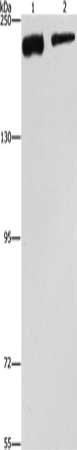 Gel: 6%SDS-PAGE, Lysate: 40 μg, Lane 1-2: NIH/3T3 cells, hela cells, Primary antibody: CLTC Antibody(CLTC Antibody) at dilution 1/300, Secondary antibody: Goat anti rabbit IgG at 1/8000 dilution, Exposure time: 40 secondsRabbit anti-Human CLTC Polyclonal Antibody