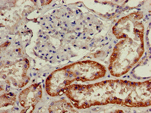 Immunohistochemistry of paraffin-embedded human kidney tissue using the antibody at dilution of 1:100Rabbit anti-Human SLC3A1 Polyclonal Antibody