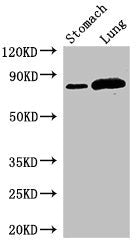 Western Blot | Positive WB detected in: Mouse stomach tissue, Rat lung tissue | All lanes: SLC3A1 antibody at 2.8μg/ml | Secondary | Goat polyclonal to rabbit IgG at 1/50000 dilution | Predicted band size: 79, 47, 46, 36, 58, 67, 64 kDa | Observed band size: 79 kDaRabbit anti-Human SLC3A1 Polyclonal Antibody