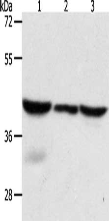 Gel: 10%SDS-PAGE, Lysate: 40 μg, Lane 1-3: Mouse lung tissue, human fetal lung tissue, hela cells, Primary antibody: CAPG Antibody(CAPG Antibody) at dilution 1/700, Secondary antibody: Goat anti rabbit IgG at 1/8000 dilution, Exposure time: 5 seconds