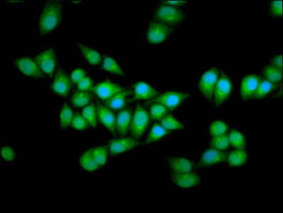 Immunofluorescence staining of Hela cells with ELP2 Antibody at 1:166, counter-stained with DAPI. The cells were fixed in 4% formaldehyde, permeabilized using 0.2% Triton X-100 and blocked in 10% normal Goat Serum. The cells were then incubated with the antibody overnight at 4°C. The secondary antibody was Alexa Fluor 488-congugated AffiniPure Goat Anti-Rabbit IgG(H+L).Rabbit anti-Human ELP2 Polyclonal Antibody