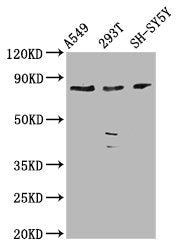 Western Blot  | Positive WB detected in: A549 whole cell lysate, 293T whole cell lysate, SH-SY5Y whole cell lysate  | All lanes: ZC3H14 antibody at 3.9µg/ml  | Secondary  | Goat polyclonal to rabbit IgG at 1/50000 dilution  | Predicted band size: 83, 66, 65, 81, 35, 33, 62, 67 kDa  | Observed band size: 83 kDaRabbit anti-Human ZC3H14 Polyclonal Antibody