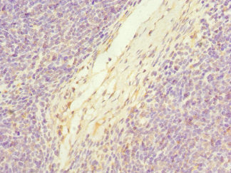 Immunohistochemistry of paraffin-embedded human thymus tissue using C19orf48 Antibody at dilution of 1:100