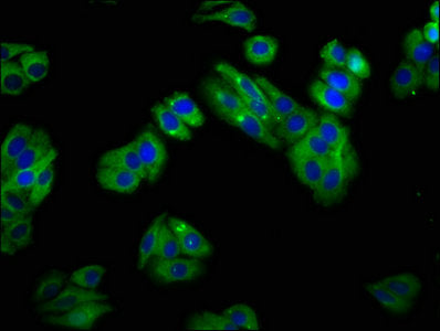 Immunofluorescence staining of HepG2 cells with SLC22A25 Antibody at 1:100, counter-stained with DAPI. The cells were fixed in 4% formaldehyde, permeabilized using 0.2% Triton X-100 and blocked in 10% normal Goat Serum. The cells were then incubated with the antibody overnight at 4°C. The secondary antibody was Alexa Fluor 488-congugated AffiniPure Goat Anti-Rabbit IgG(H+L).Rabbit anti-Human SLC22A25 Polyclonal Antibody