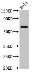 Western Blot | Positive WB detected in: Hela whole cell lysate | All lanes: SLC22A25 antibody at 6.8μg/ml | Secondary | Goat polyclonal to rabbit IgG at 1/50000 dilution | Predicted band size: 62 kDa | Observed band size: 62 kDaRabbit anti-Human SLC22A25 Polyclonal Antibody