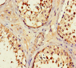 Immunohistochemistry of paraffin-embedded human testis tissue using OPN5 Antibody at dilution of 1:100Rabbit anti-Human OPN5 Polyclonal Antibody