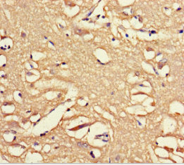 Immunohistochemistry of paraffin-embedded human brain tissue using OPN5 Antibody at dilution of 1:100Rabbit anti-Human OPN5 Polyclonal Antibody