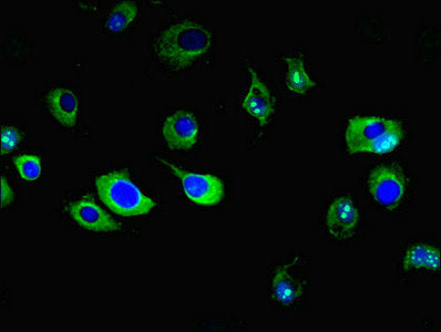Immunofluorescent analysis of MCF-7 cells using ENPP6 Antibody at dilution of 1:100 and Alexa Fluor 488-congugated AffiniPure Goat Anti-Rabbit IgG(H+L)Rabbit anti-Human ENPP6 Polyclonal Antibody