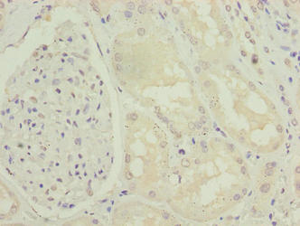 Immunohistochemistry of paraffin-embedded human kidney tissue using the antibody at dilution of 1:100Rabbit anti-Human ENPP6 Polyclonal Antibody
