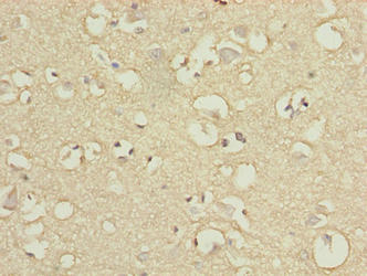 Immunohistochemistry of paraffin-embedded human brain tissue using ENPP6 Antibody at dilution of 1:100Rabbit anti-Human ENPP6 Polyclonal Antibody
