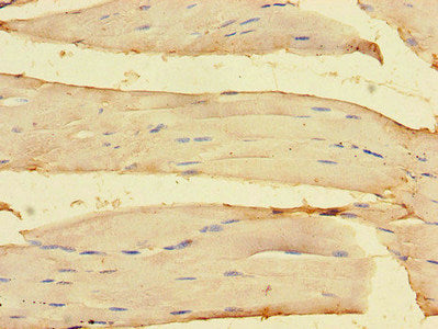 Immunohistochemistry of paraffin-embedded human skeletal muscle tissue using OLFML1 Antibody at dilution of 1:100Rabbit anti-Human OLFML1 Polyclonal Antibody