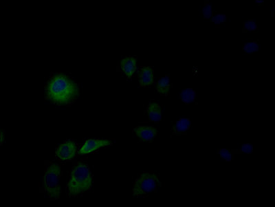 Immunofluorescence staining of Hela cells with CLEC9A Antibody at 1:50, counter-stained with DAPI. The cells were fixed in 4% formaldehyde, permeabilized using 0.2% Triton X-100 and blocked in 10% normal Goat Serum. The cells were then incubated with the antibody overnight at 4°C. The secondary antibody was Alexa Fluor 488-congugated AffiniPure Goat Anti-Rabbit IgG(H+L).Rabbit anti-Human CLEC9A Polyclonal Antibody