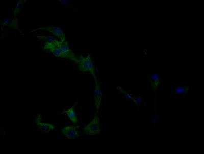 Immunofluorescence staining of MCF-7 cells with CLEC9A Antibody at 1:50, counter-stained with DAPI. The cells were fixed in 4% formaldehyde, permeabilized using 0.2% Triton X-100 and blocked in 10% normal Goat Serum. The cells were then incubated with the antibody overnight at 4°C. The secondary antibody was Alexa Fluor 488-congugated AffiniPure Goat Anti-Rabbit IgG(H+L).Rabbit anti-Human CLEC9A Polyclonal Antibody