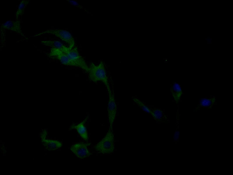 Immunofluorescence staining of MCF-7 cells with CLEC9A Antibody at 1:50, counter-stained with DAPI. The cells were fixed in 4% formaldehyde, permeabilized using 0.2% Triton X-100 and blocked in 10% normal Goat Serum. The cells were then incubated with the antibody overnight at 4°C. The secondary antibody was Alexa Fluor 488-congugated AffiniPure Goat Anti-Rabbit IgG(H+L).Rabbit anti-Human CLEC9A Polyclonal Antibody