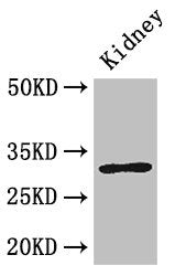 Western Blot  | Positive WB detected in: Mouse kidney tissue  | All lanes: FAM151B antibody at 2.6µg/ml  | Secondary  | Goat polyclonal to rabbit IgG at 1/50000 dilution  | Predicted band size: 32 kDa  | Observed band size: 32 kDaRabbit anti-Human FAM151B Polyclonal Antibody
