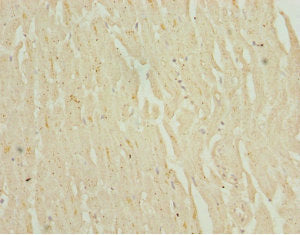 Immunohistochemistry of paraffin-embedded human heart tissue using NHLRC1 Antibody at dilution of 1:100Rabbit anti-Human NHLRC1 Polyclonal Antibody