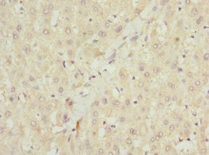 Immunohistochemistry of paraffin-embedded human liver tissue using NHLRC1 Antibody at dilution of 1:100Rabbit anti-Human NHLRC1 Polyclonal Antibody