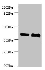 Western blot | All lanes: NHLRC1 antibody at 3.13μg/ml | Lane 1: LO2 whole cell lysate | Lane 2: Rat liver tissue | Secondary | Goat polyclonal to rabbit IgG at 1/10000 dilution | Predicted band size: 42 kDa | Observed band size: 42 kDaRabbit anti-Human NHLRC1 Polyclonal Antibody