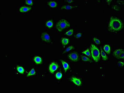 Immunofluorescent analysis of PC-3 cells using ATG14 Antibody at dilution of 1:100 and Alexa Fluor 488-congugated AffiniPure Goat Anti-Rabbit IgG(H+L)Rabbit anti-Human ATG14 Polyclonal Antibody