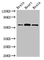 Western Blot | Positive WB detected in: Rat brain tissue, Mouse heart tissue, Mouse brain tissue | All lanes: ATG14 antibody at 2μg/ml | Secondary | Goat polyclonal to rabbit IgG at 1/50000 dilution | Predicted band size: 56, 43 kDa | Observed band size: 56 kDaRabbit anti-Human ATG14 Polyclonal Antibody