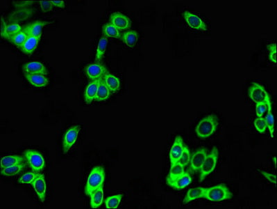 Immunofluorescent analysis of HepG2 cells using PREX2 Antibody at dilution of 1:100 and Alexa Fluor 488-congugated AffiniPure Goat Anti-Rabbit IgG(H+L)Rabbit anti-Human PREX2 Polyclonal Antibody