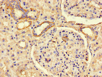 Immunohistochemistry of paraffin-embedded human kidney tissue using PREX2 Antibody at dilution of 1:100Rabbit anti-Human PREX2 Polyclonal Antibody