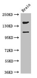 Western Blot | Positive WB detected in: Mouse brain tissue | All lanes: PREX2 antibody at 3.4μg/ml | Secondary | Goat polyclonal to rabbit IgG at 1/50000 dilution | Predicted band size: 183, 172, 113 kDa | Observed band size: 183, 113 kDaRabbit anti-Human PREX2 Polyclonal Antibody