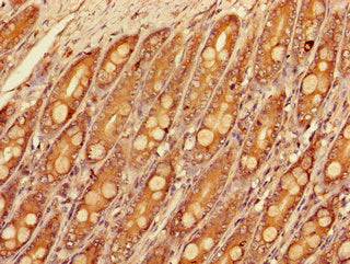 Immunohistochemistry of paraffin-embedded human small intestine tissue using SLC16A9 Antibody at dilution of 1:100Rabbit anti-Human SLC16A9 Polyclonal Antibody